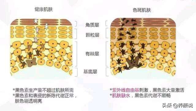 ​护肤品越用越多，肌肤状态急剧下滑，护肤品真的有效？