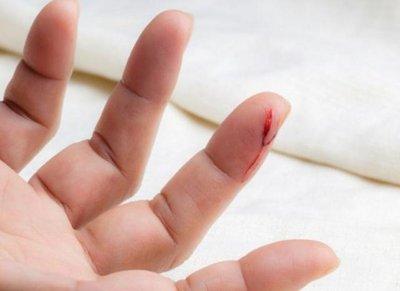 儿童简单外伤的处理方法,如何讲解儿童外伤处理小常识