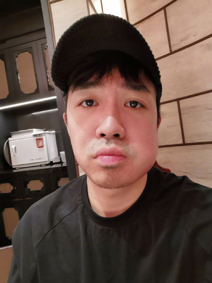 俞灏明的脸能修复吗,俞灏明的脸怎么修复的