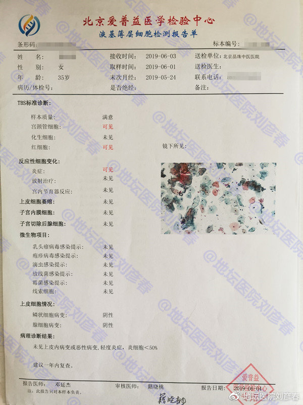 女，35岁，CIN2级，姑娘们，还以为宫颈癌离你们很远吗？