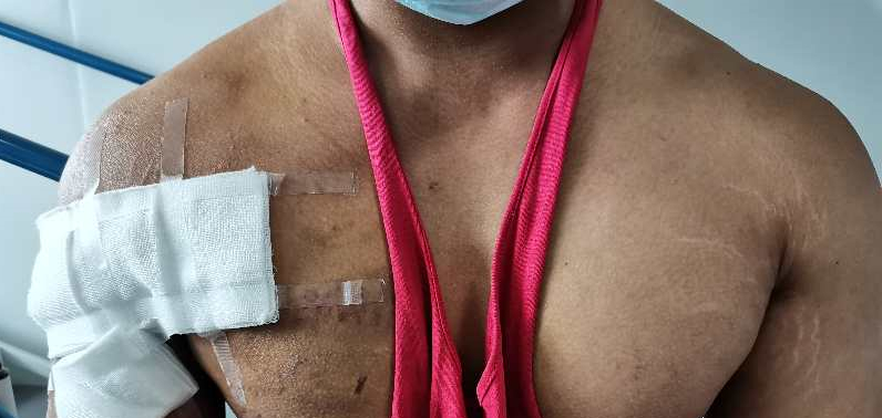 健身教练举杠铃被压伤,健身教练卧举380斤失败