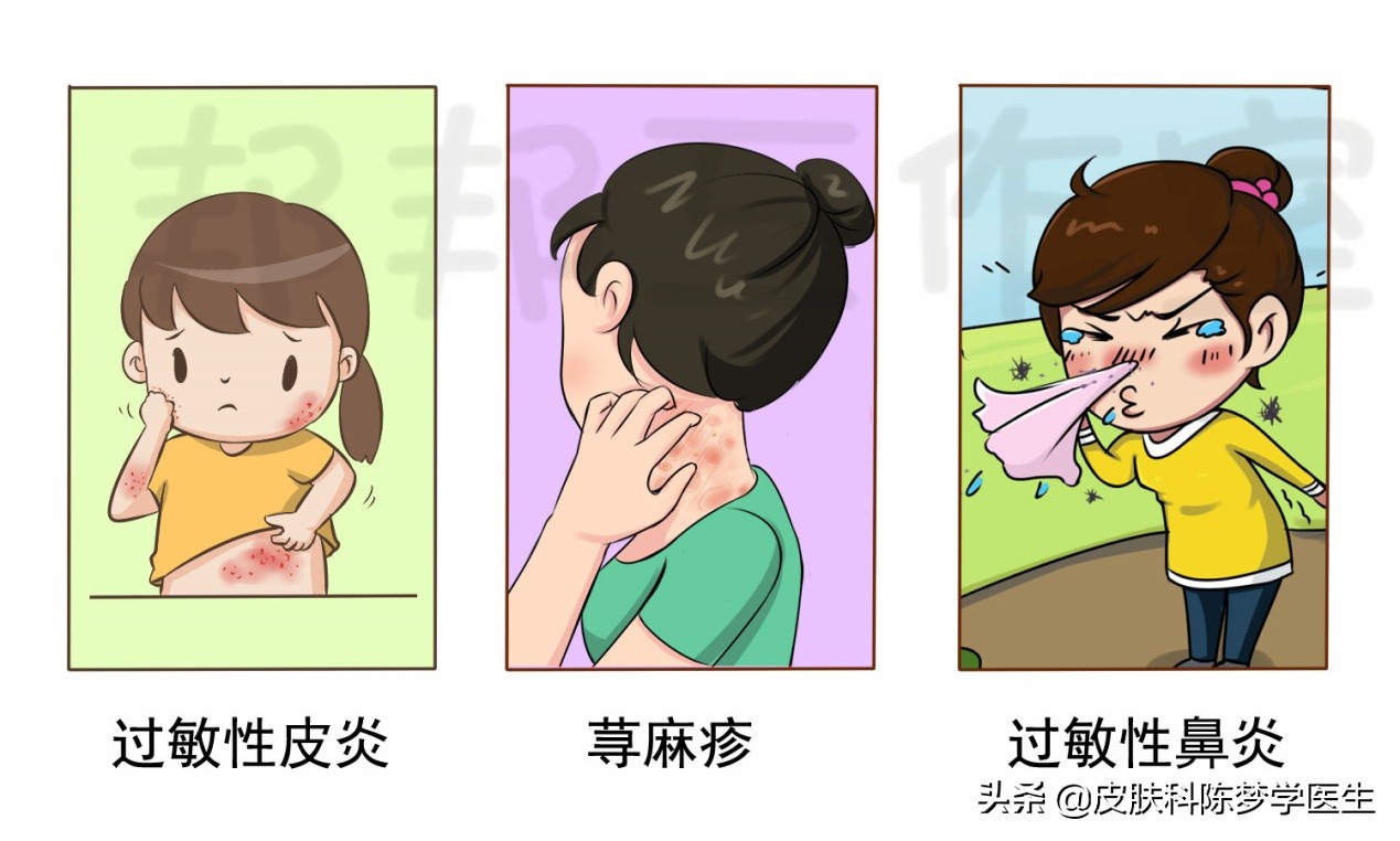 皮肤过敏发红有黄水渗出吃什么药,春季过敏眼痒打喷嚏流鼻涕