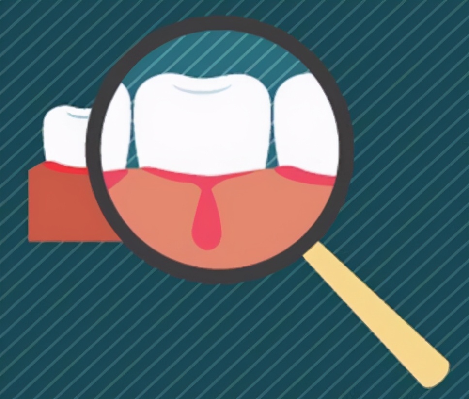 牙痛怎么办早期三大症状,请说出牙痛九个诱因