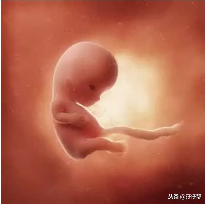 怀孕10周双胞胎一个胎停了怎么办,怀孕10周双胞胎