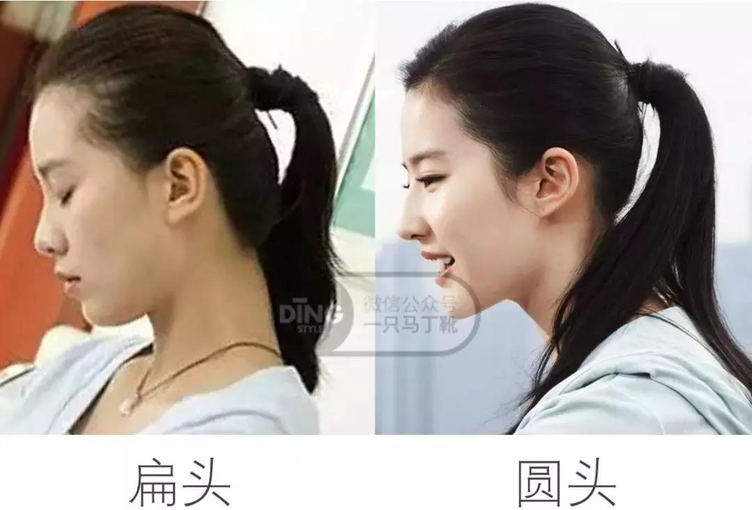 扁头怎么让头变得饱满些,扁头怎么办最快最有效