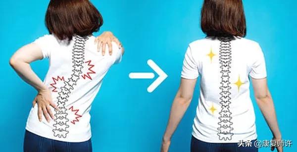 成人肋骨外翻危害,为什么会肋骨外翻出大包