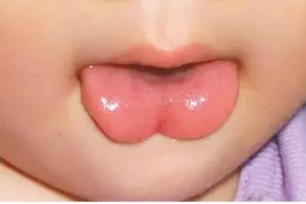 贵人语迟小孩说话迟,贵人语迟和孩子说话