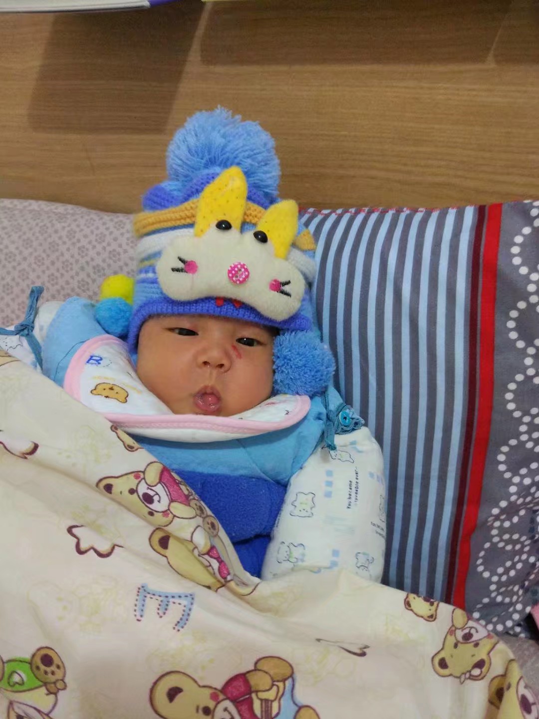 儿童血管瘤治疗成功经历,宝宝血管瘤康复过程视频