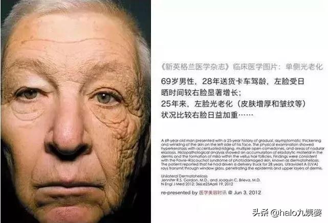 宋轶和黄圣依哪个好,不防晒mistine