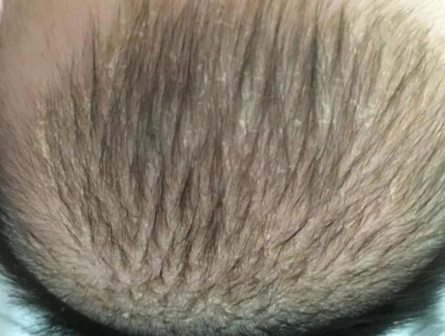 新生儿常见的皮肤问题,新生儿心脏血管常见问题