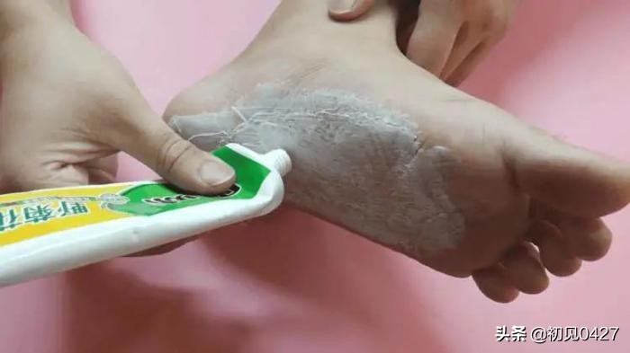 睡前脚上涂牙膏会怎么样,得了脚气用牙膏涂抹可以吗