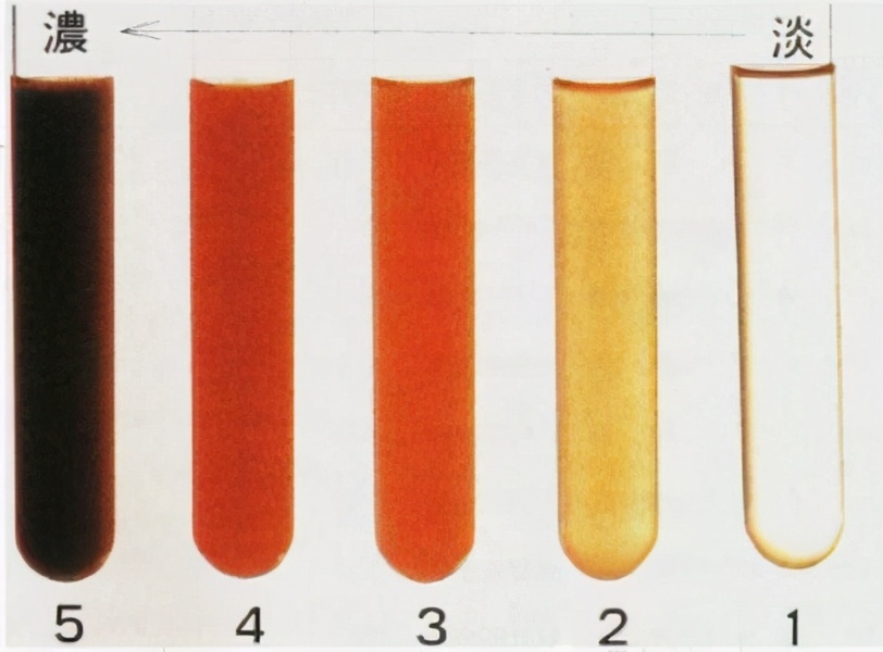 尿尿泡沫多是湿热吗,尿尿泡沫多尿臭是什么原因