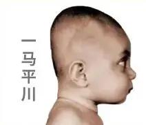 一岁宝宝睡偏头戴婴儿矫正头盔,七个月宝宝戴头盔多久能纠正头型