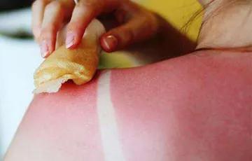 皮肤科主任王教授,上海中医院皮肤科王教授