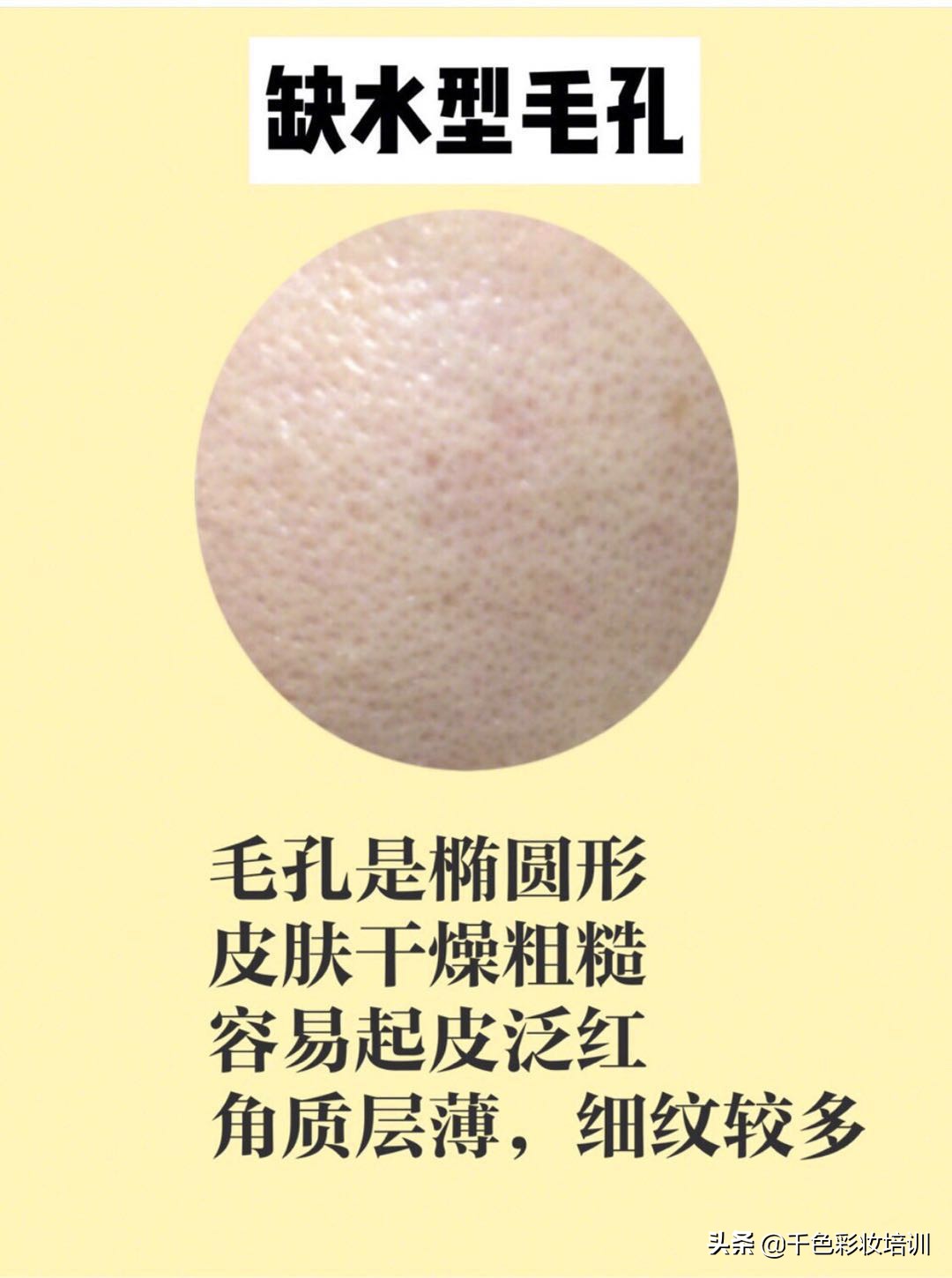 毛孔粗大怎么办怎么有效收缩毛孔,毛孔粗大怎么办教你几招收缩毛孔