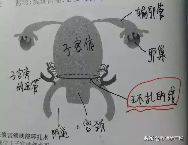 反复性流产再孕如何保胎,有习惯性流产史备孕怎么调理