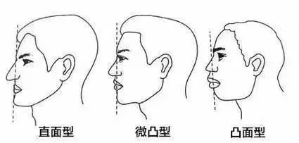 嘴凸的女生其实也很好看,凸嘴女生怎么微笑好看