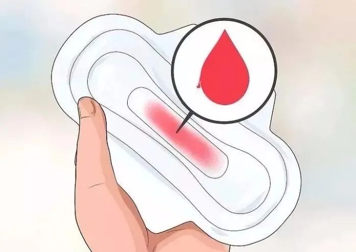 排卵期出血有可能是宫颈癌么,排卵期出血可能会是宫外孕吗