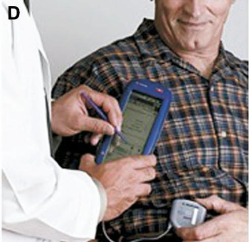 帕金森患者脑深部电刺激护理,帕金森脑深部电刺激手术步骤