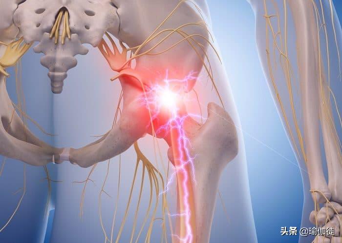 翘屁股影响发育吗,翘二郎腿骨盆倾斜危害