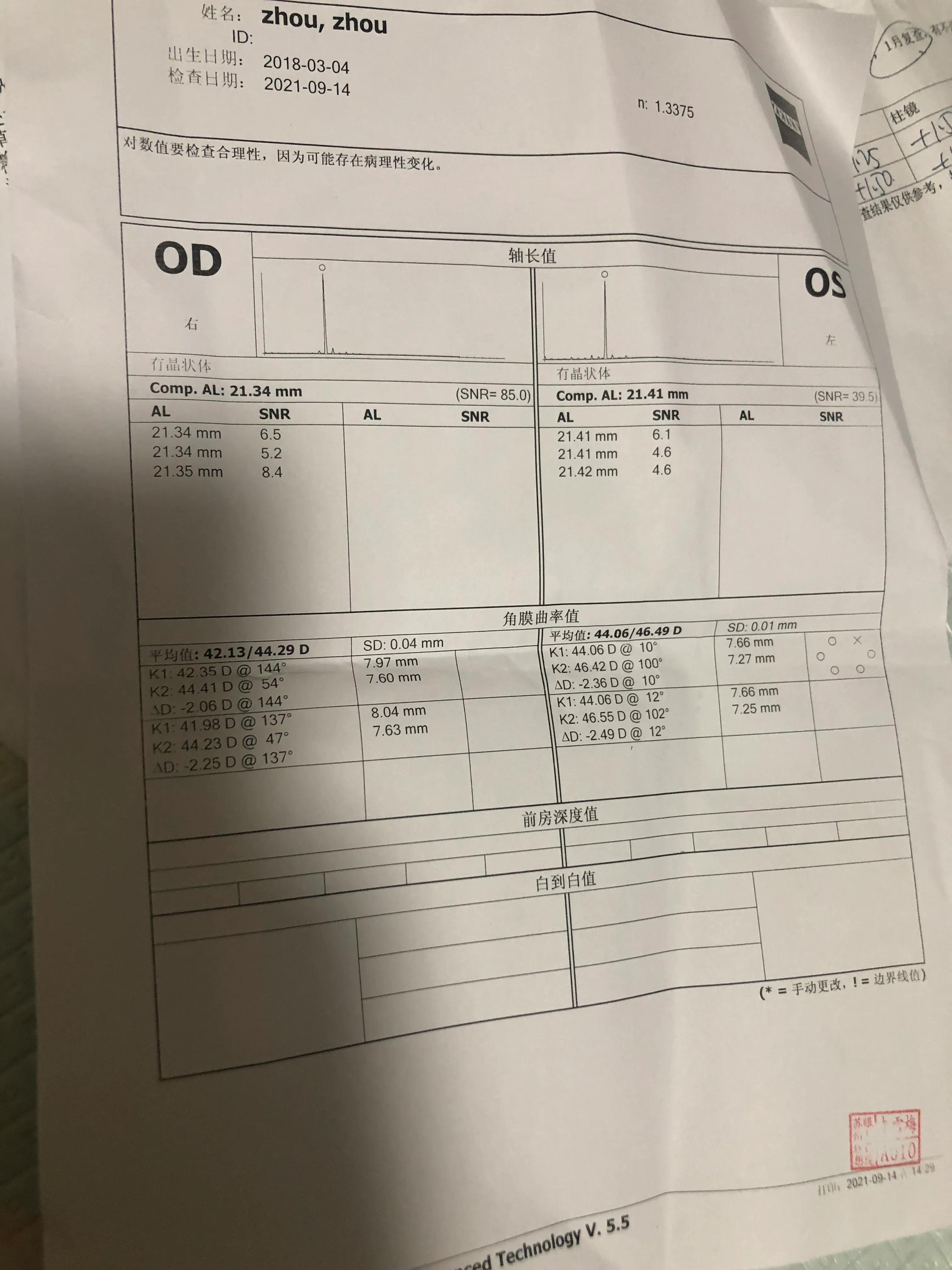 幼儿园体检散光3.0严重吗,3岁体检散光