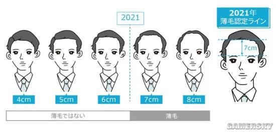 所以秃头的标准是发际线高≥7cm?头秃代表不再是中老年独扛大旗,90后、00后也在积极踊跃加入组织