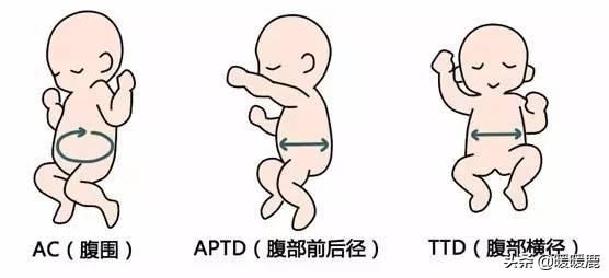 怎么判断胎儿腹围大小图解,怎么判断胎儿双顶径大