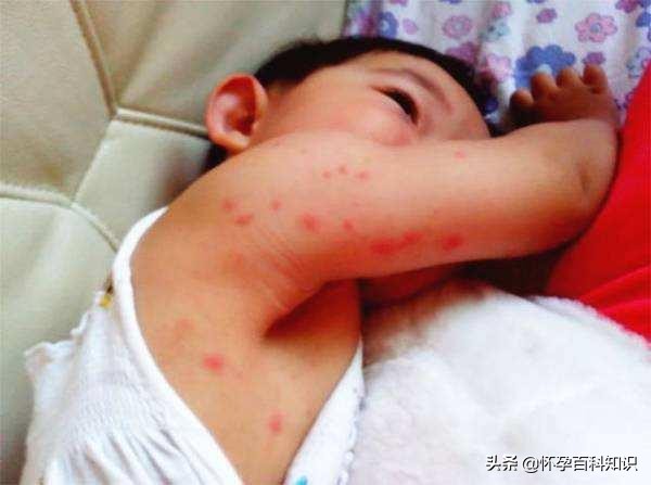 防蚊虫花露水管用吗,防蚊止痒花露水管用吗