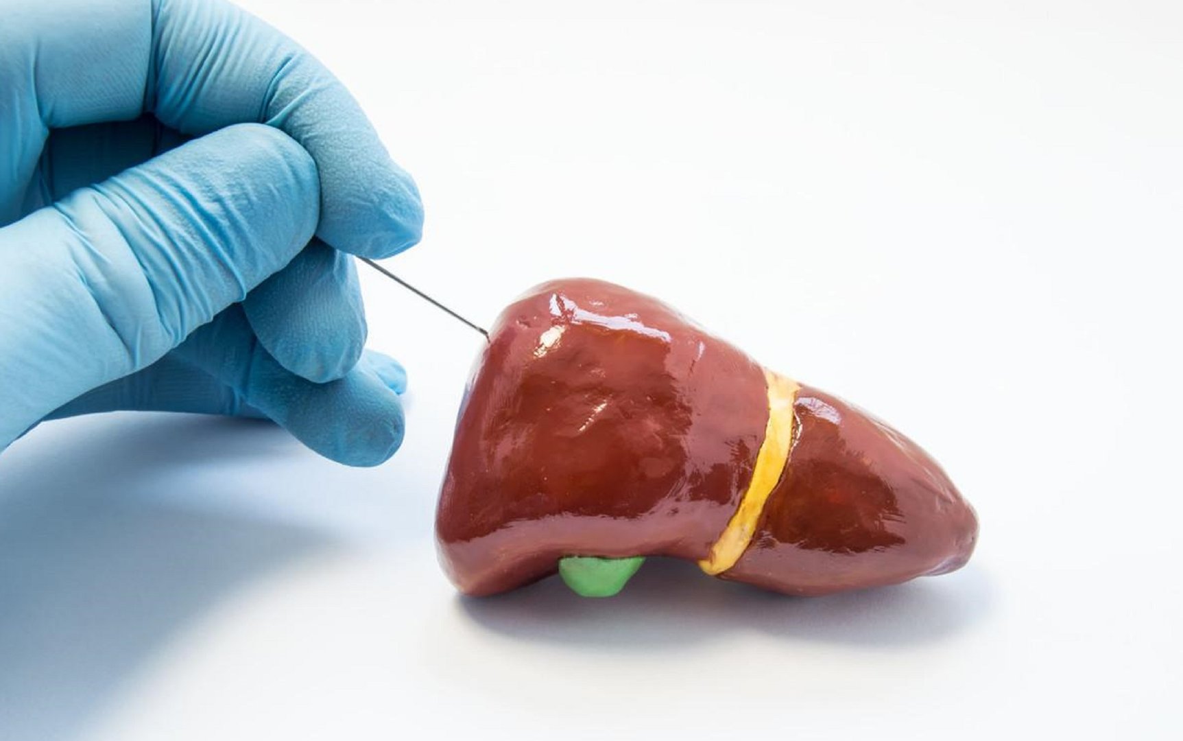 肝衰竭有治愈的希望吗,重度肝衰竭是什么原因造成的