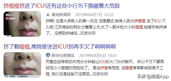 挤痘一定要挤出血吗,徒手挤了痘痘怎么办