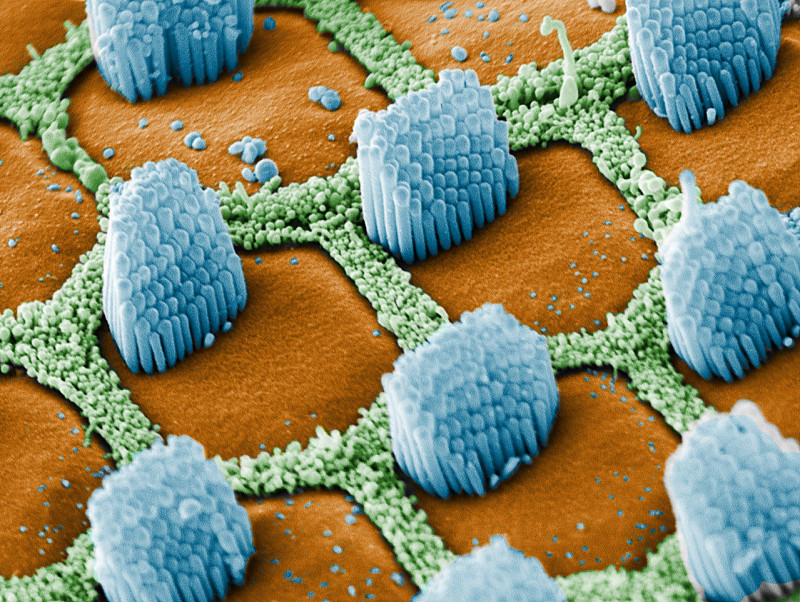 一般人绝对想不到,身体上的毛有哪几种