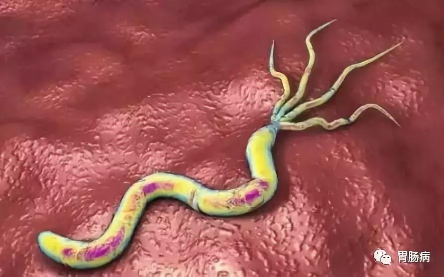 幽门螺杆菌为什么杀不死,幽门螺杆菌根除失败后的补救方案