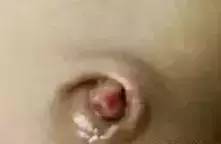 新生儿各种肚脐,新生儿肚脐容易出现的问题