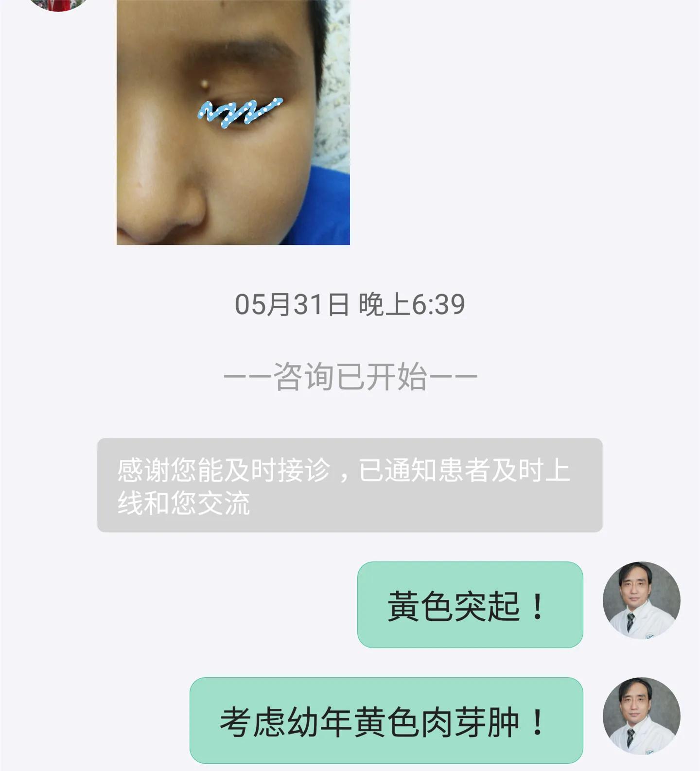 一岁孩子眼皮有几个疹子,小孩上眼皮长的像癣一样的东西