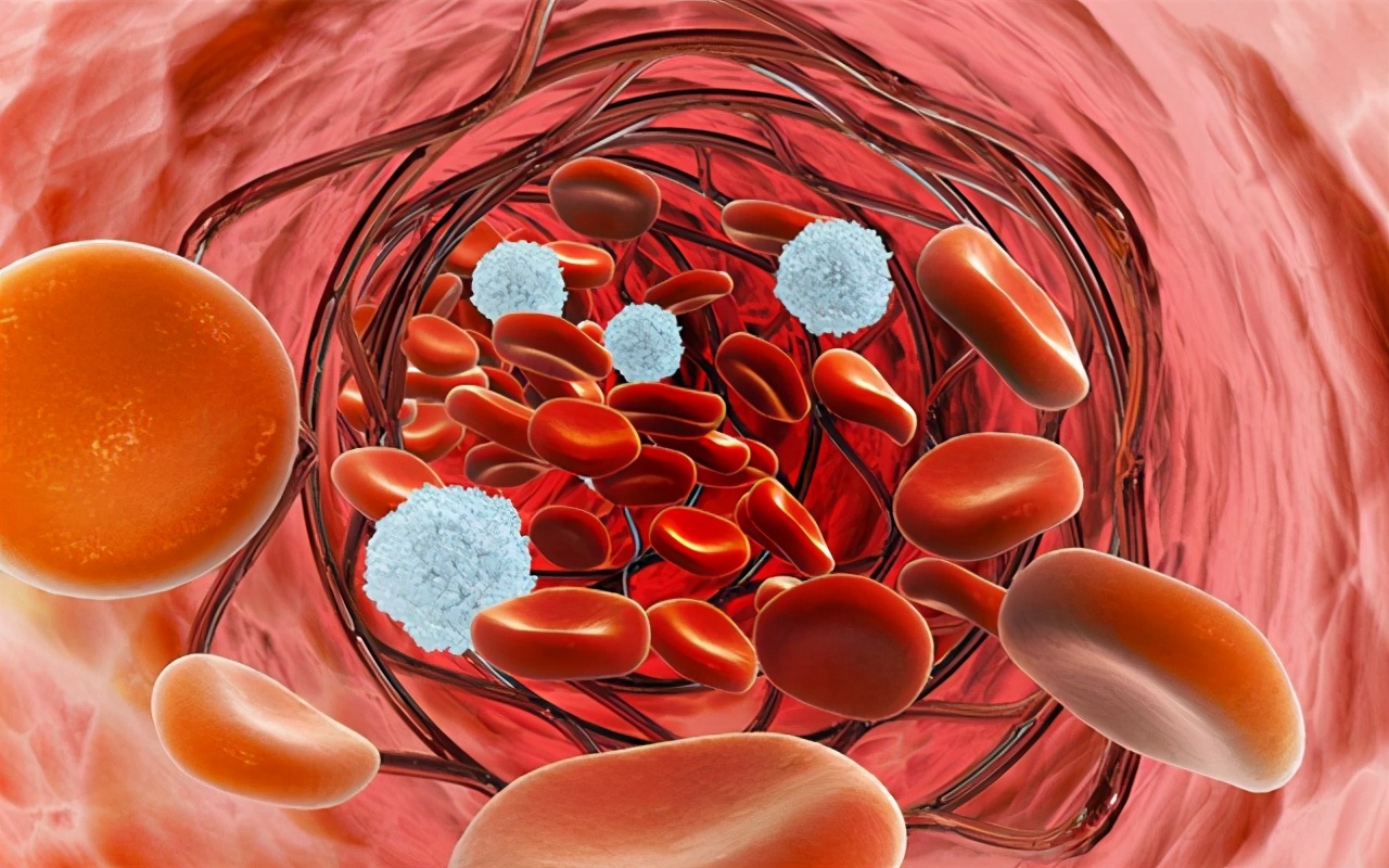 老人得了过敏性紫癜为什么治不好,过敏性紫癜是血液病终身治不好吗