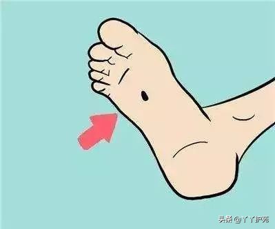 黑痣一定要处理掉吗,黑痣一定要去除吗