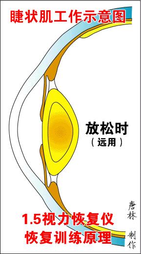 想不到！这些“怪招”竟然可以预防近视