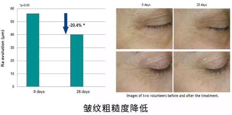 韩国大牌眼霜,吴昕爱马仕眼霜怎么样