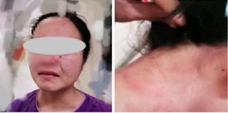 确诊外籍黑人男子咬伤广州护士，狂躁想强行走出隔离病房，被拦后推倒护士殴打，外交部称扰乱防疫秩序将追责