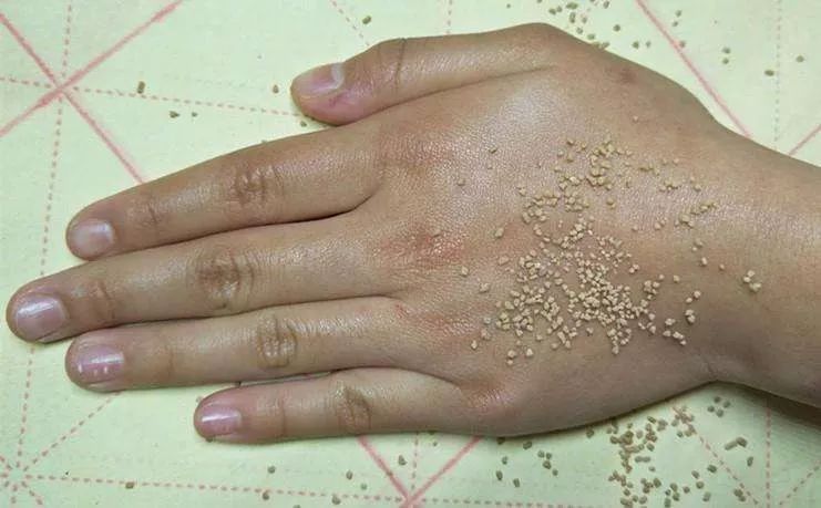 手干燥粗糙手纹深用什么护肤产品,可以改善手纹粗糙的护手霜