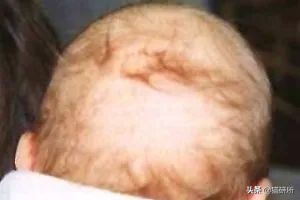 天天吸猫猫毛会被吸进身体里吗,肺里能吸进猫毛么