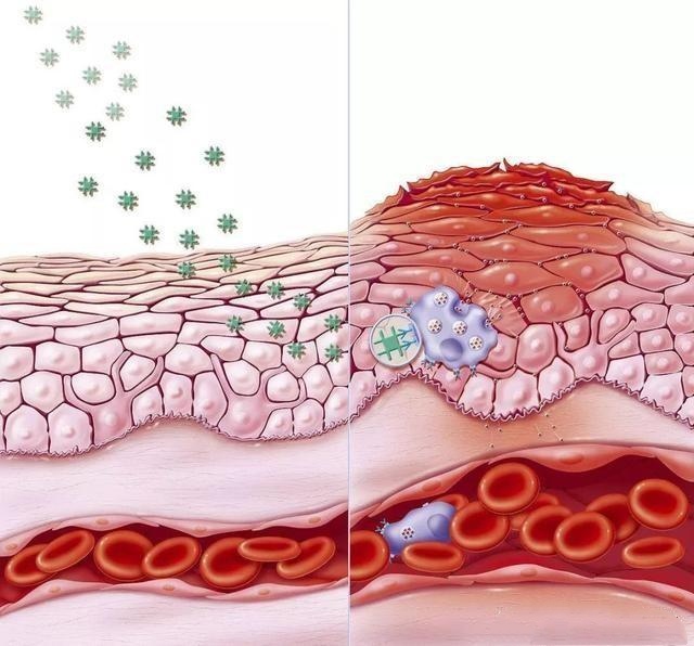 皮肤很痒不能挠怎么缓解,皮肤瘙痒的受不了怎么办