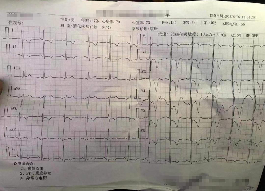 35岁突然心肌梗死什么原因,心肌梗死恢复期出现胸闷怎么办