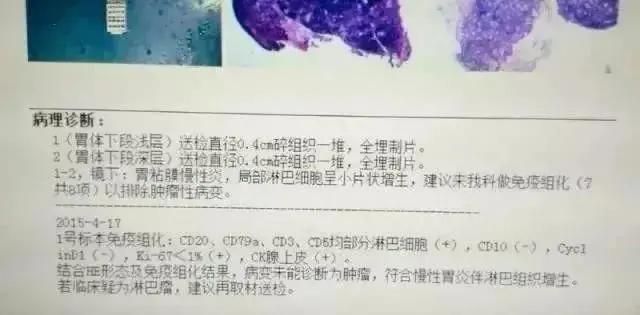 临床医生：3分钟看懂，胃镜活检病理报告！一定要收藏