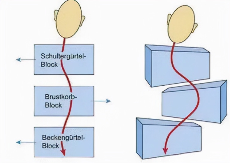 脊柱无侧弯但两侧腰线不对称,两边腰线弧度不一样是脊柱侧弯吗