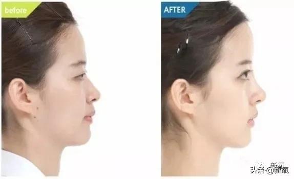 宁静和郑希怡对比,郑希怡和宁静对比