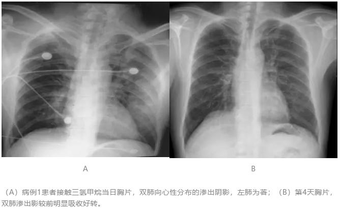 工人用稀料清理泡沫10分钟即意识丧失,肝功能异常是否为切入点?