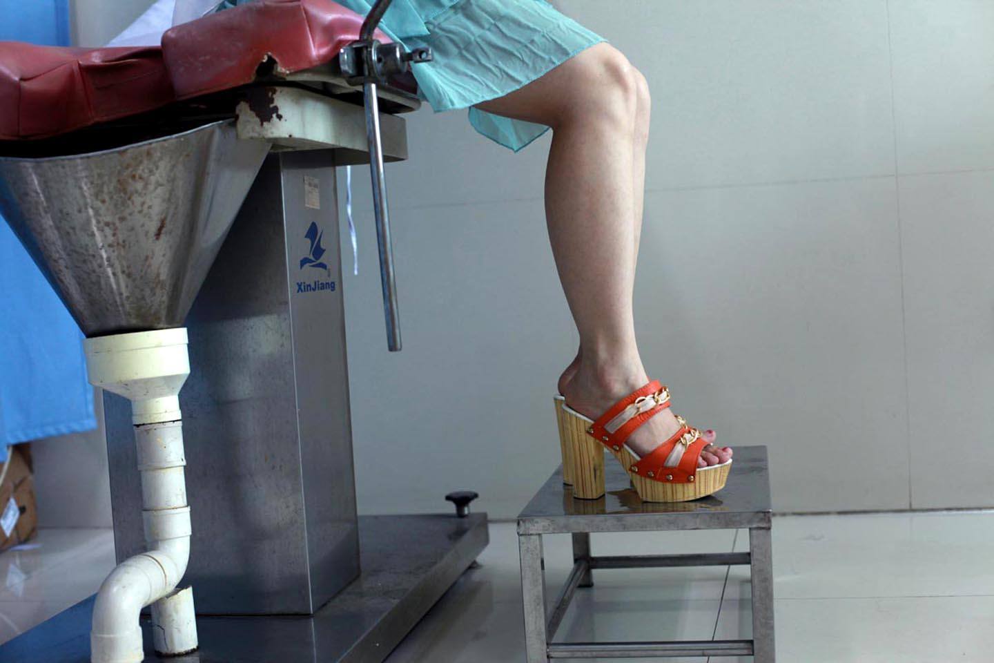 人流手术后子宫里会有疤痕吗,人流手术后子宫会变松吗