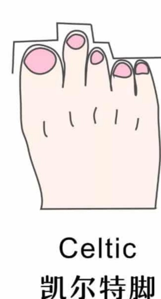 女性脚型有哪几种,脚型丑怎么才能变得好看点