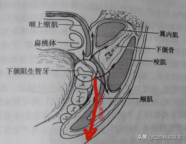 别让一颗牙齿毁了一张脸?医生说95%的人都有这样的牙齿!